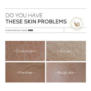 Anti Aigin Moisturizing Skin Care Products Laikou Snail Cream For All Seasons