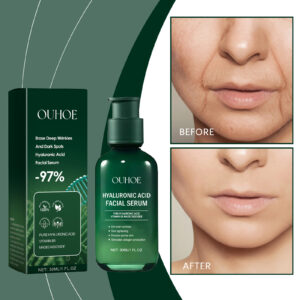 OUHOE Hyaluronic Acid Facial Serum (30ml) – Anti-Aging Face Serum with Vitamin B5 & Madecassoside for Wrinkles, Dark Spots & Firming
